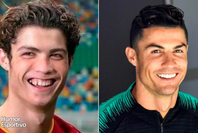 Antes e depois: 20 jogadores de futebol que mudaram muito com o tempo