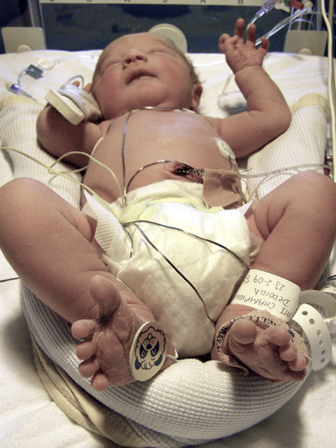 <p>Novembro foi o mês roxo no calendário de cores que remetem às datas da saúde: Mês da Prematuridade. Mas os cuidados, claro, têm que ser rigorosos o ano inteiro. Veja dicas importantes. </p>
