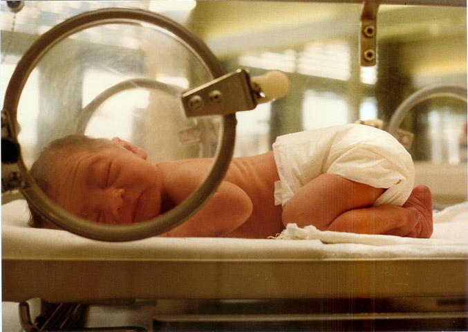 <p>A prematuridade pode ser espontânea (quando, de repente, a mulher entra em trabalho de parto) ou induzida (quando o obstetra opta por antecipar o parto por risco à vida da mãe ou do bebê). </p>
