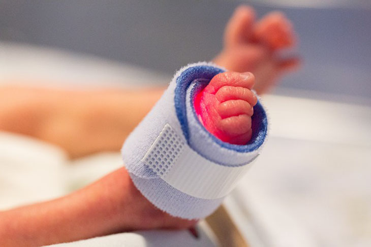Os cuidados com os bebês prematuros. Veja o que fazer