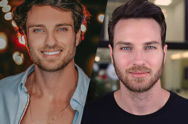 Mattar fez o procedimento na mesma clÃ­nica que atendeu ao ex-BBB Lucas Bissoli. Lucas tambÃ©m optou por dar uma guaribada no rosto e publicou a comparaÃ§Ã£o nas redes sociais. 