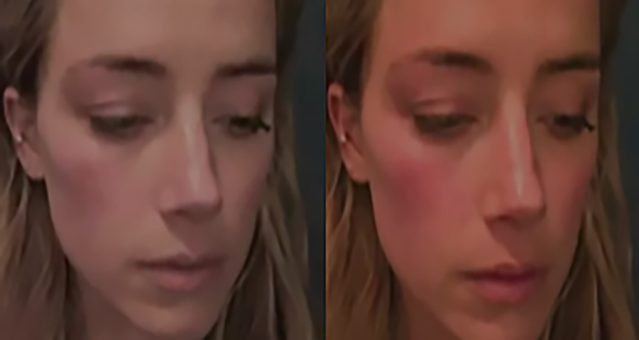 Amber apresentou uma foto com rosto vermelho após suposta agressão do marido. Mas a defesa de Depp comparou com outra fotografia da mesma ocasião, em que o rosto estava mais claro. E um especialista testemunhou dizendo que teria havido edição na foto levada pela defesa da atriz.