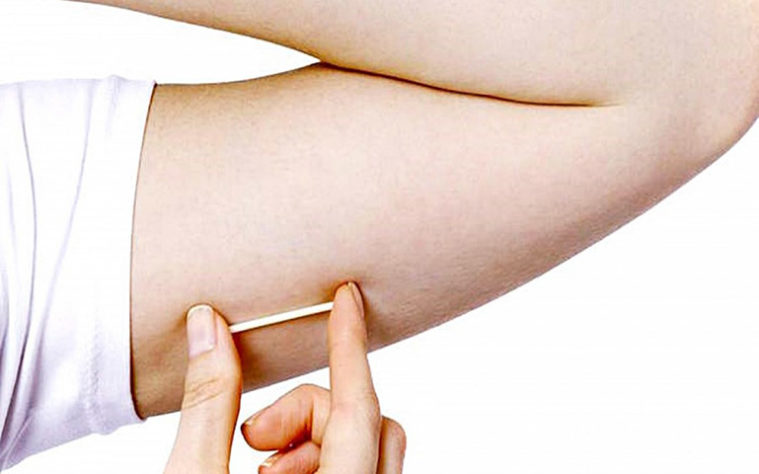chip-da-beleza-implante-hormonal-gestrinona