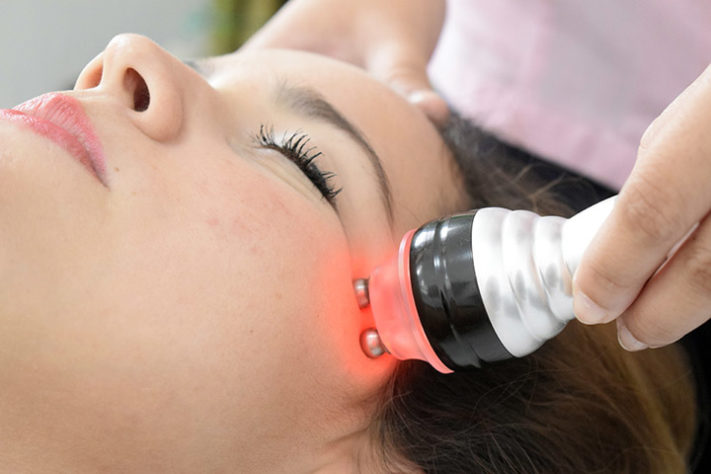 harmonização facial
