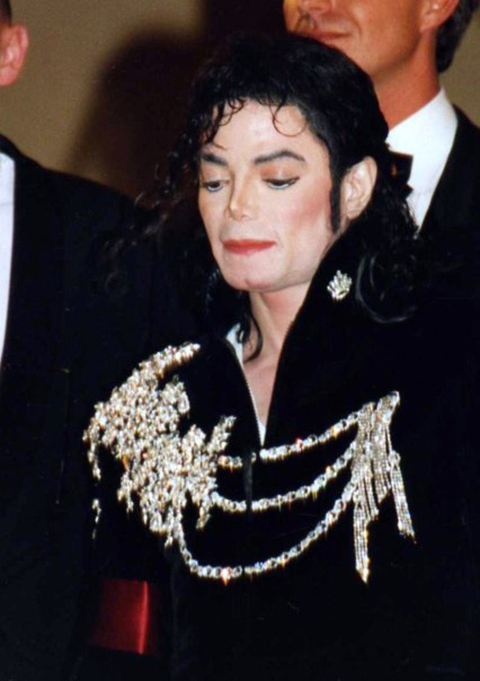 Michael sofria de vitiligo e visitava o dermatologista regularmente. Segundo o médico, a transformação em sua aparência não foi uma escolha, mas uma consequência natural da progressão da doença.