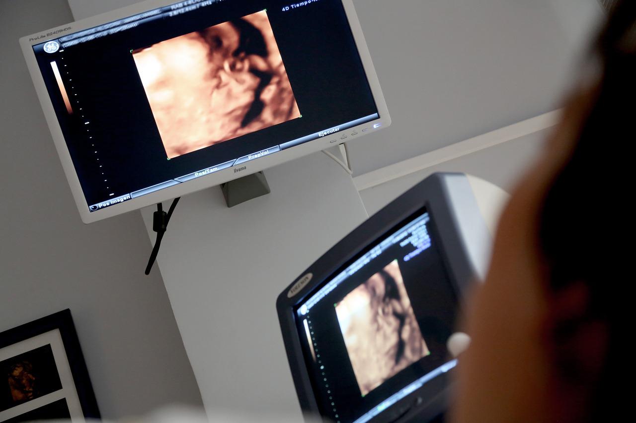  “O ultrassom e a ressonância magnética, sem riscos e desconfortos, fornecem imagens que podem ser impressas em 3D, com o bebê em formação", destacou o Dr. Heron Werner, especialista em Ginecologia, Obstetrícia e Medicina Fetal do CDPI.