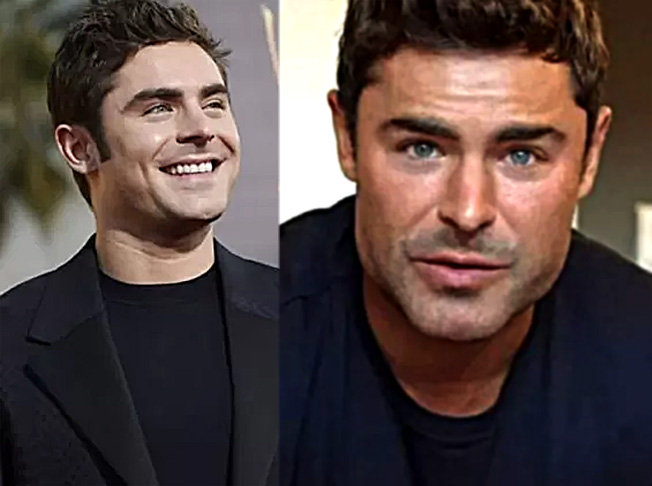 Zac Efron aparece com rosto diferente e fãs o comparam com