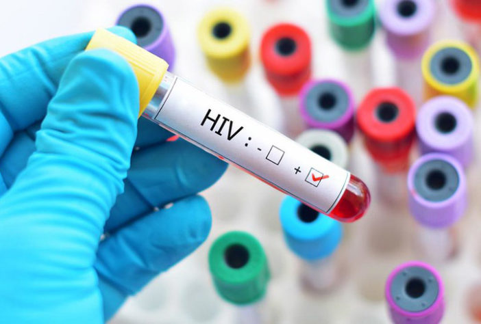 AIDS-HIV