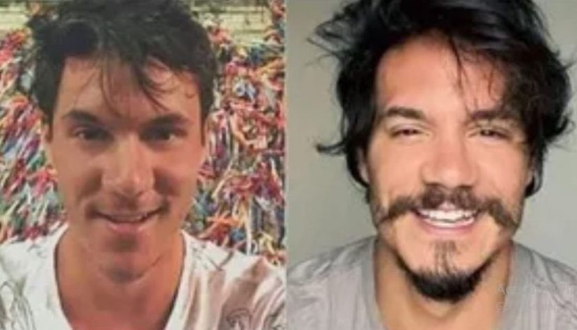 Eliezer Harmonização Facial - Reprodução/Redes Sociais