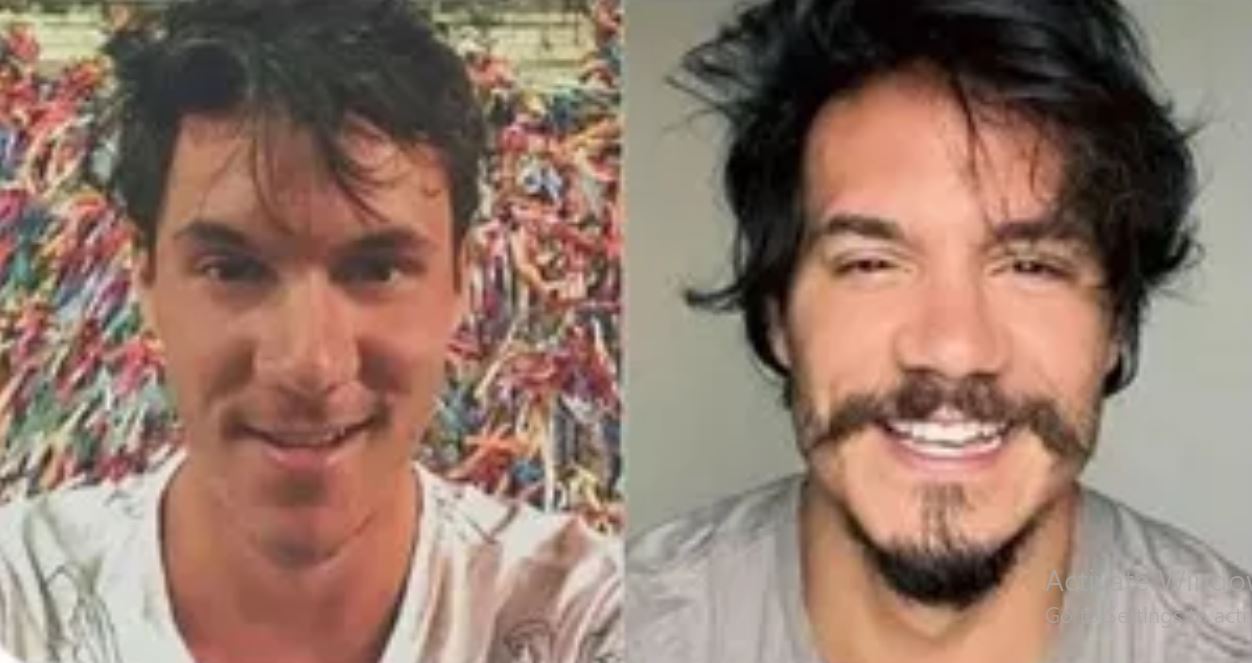 O designer Eliezer, nascido em Volta Redonda (RJ), fez uma série de harmonizações antes de participar do BBB22. Ele disse que achava seu rosto muito fino e o queixo projetado para frente e decidiu gastar R$ 14 mil para 