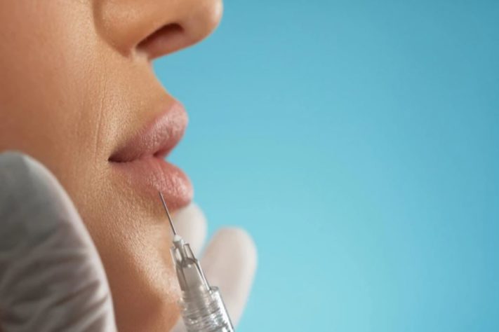 harmonização facial