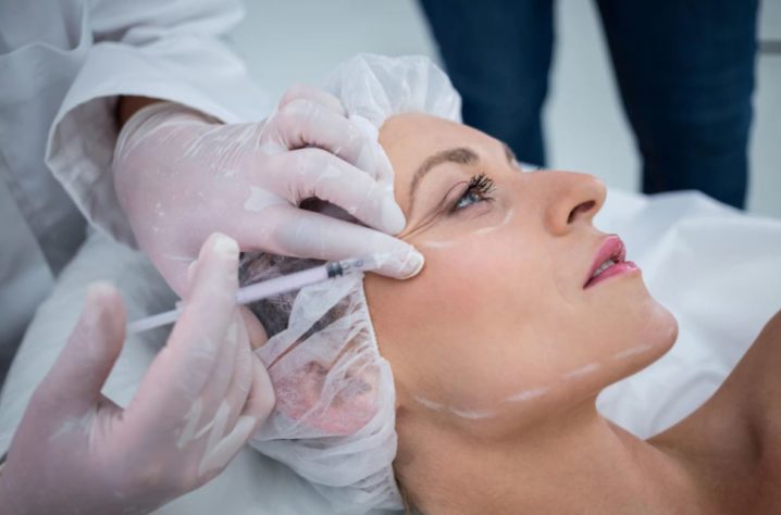 harmonização facial