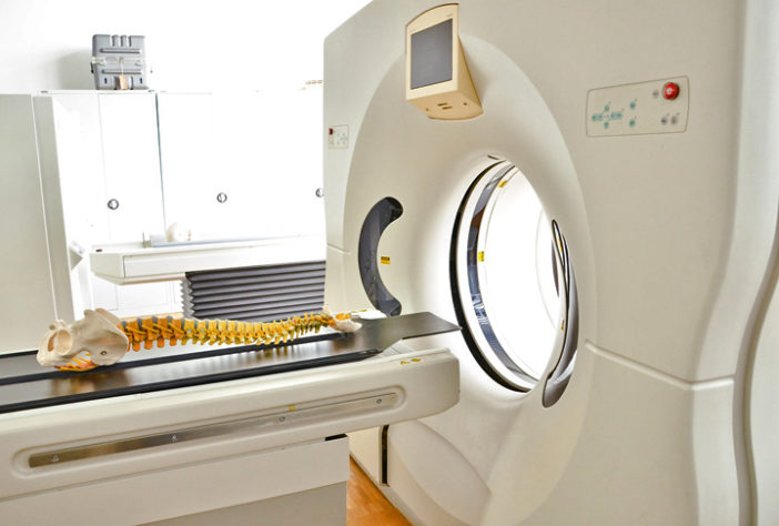 Tomografia Computadorizada