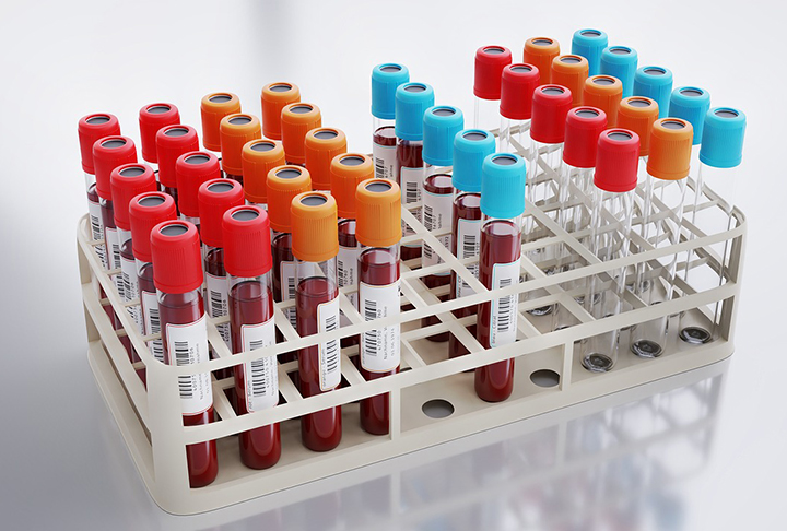 Em junho, um estudo da Universidade Johns Hopkins, publicado na revista Cancer Discovery, revelou que um exame de sangue pode detectar sinais de câncer até três anos antes do surgimento de sintomas.