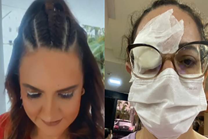 <p>Só no Recife, em Pernambuco, mais de 200 pessoas tiveram que ser atendidas no pronto-socorro depois que a pomada atingiu seus olhos. </p>
