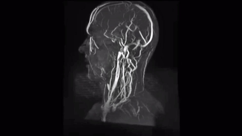 Ele usa a tecnologia para conhecer o próprio corpo e saber o que ele necessita. Faz os exames nos aparelhos em casa, com a assistência de especialistas. 