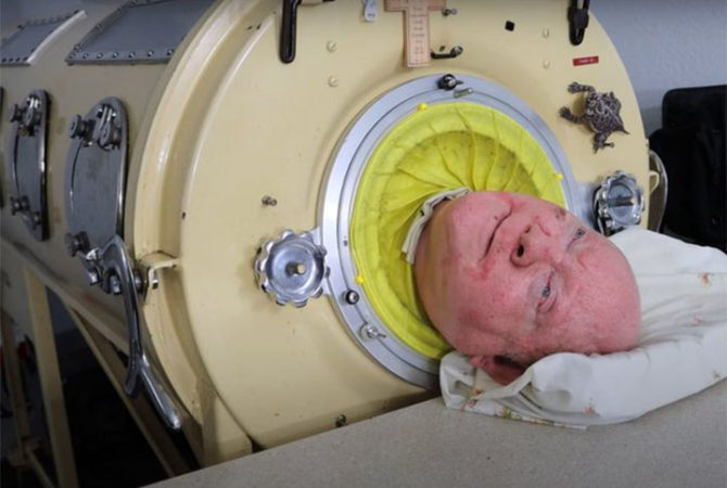 Homem viveu 7 décadas numa máquina de respiração, mas até formou-se em Direito