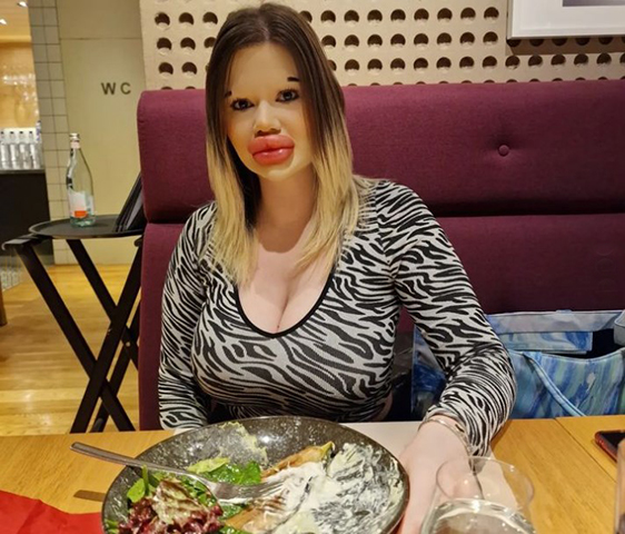 Mas a busca por diversos recordes estranhos nem sempre traz consequências tão dramáticas. A búlgara Andrea Ivanoa, por exemplo, realizou 43 procedimentos estéticos e gastou mais de R$ 92 mil para ter os maiores lábios do mundo. E conseguiu. 