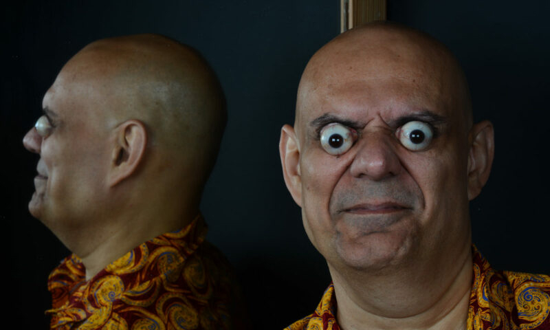 Em outubro de 2022, o brasileiro Sidney Carvalho foi incluído no Guinness Book por conseguir projetar os olhos em até 18,2 milímetros além das suas órbitas oculares. Em algumas pessoas, isso pode ser fruto de uma doença. 