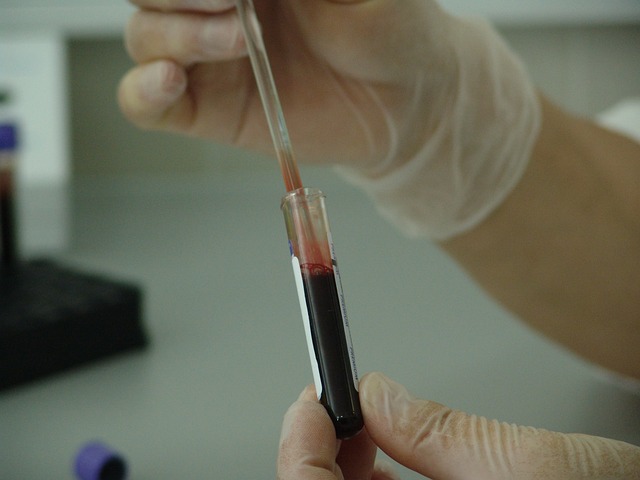 O colesterol alto geralmente não apresenta sintomas, sendo detectado apenas por exame de sangue. Por isso, é importante realizar check-ups periódicos.