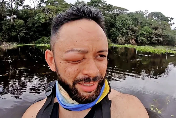 Atenção: Esses animais podem causar reação alérgica