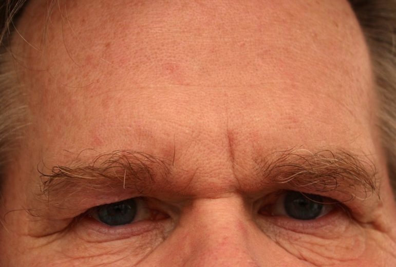 Agora olha essa: em um evento ocorrido em 2005, o cidadão norte-americano Andrew Fischer decidiu leiloar sua própria testa para servir como um 