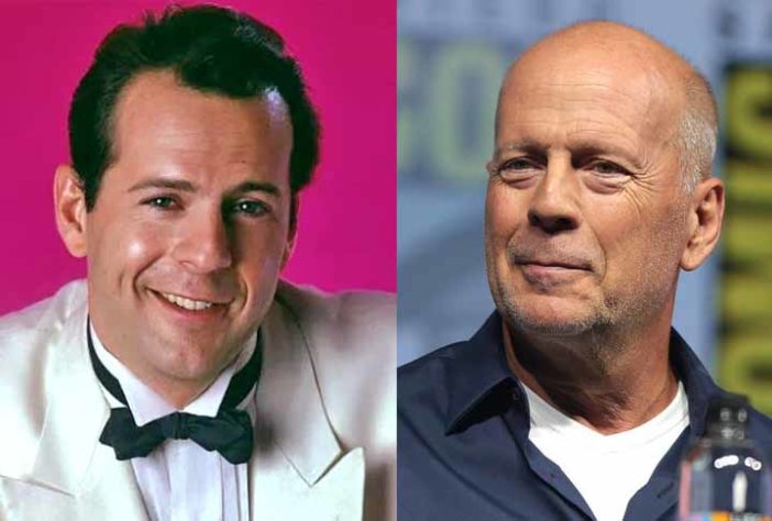 Atores famosos que ficaram carecas