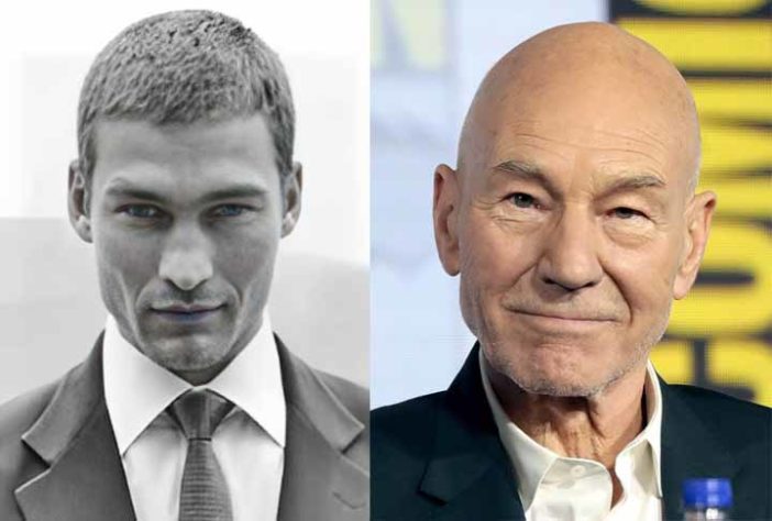 Atores famosos que ficaram carecas