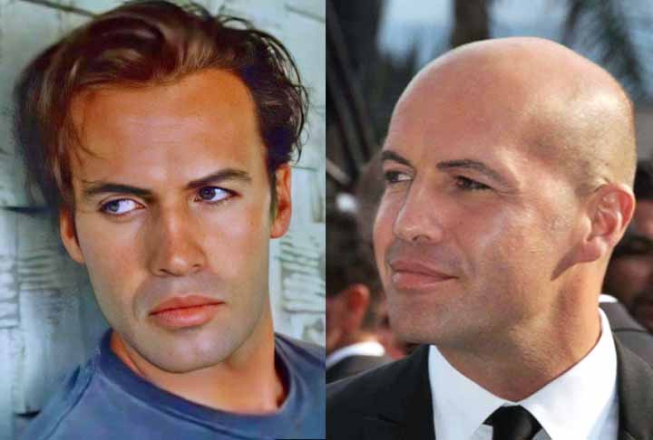 10 famosos carecas que já foram cabeludos; veja o antes e depois -  Observatório do Cinema