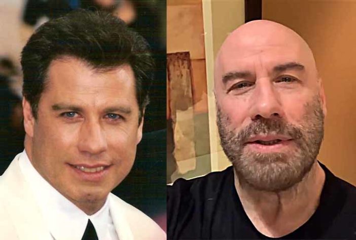 Atores famosos que ficaram carecas