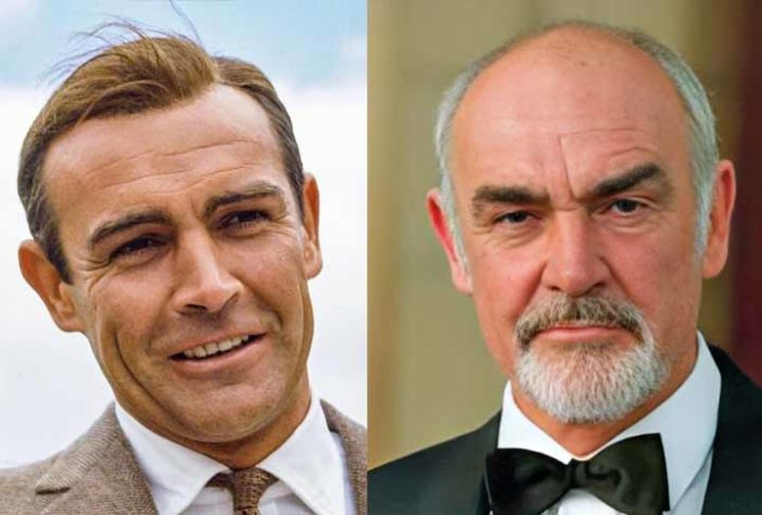 Atores famosos que ficaram carecas