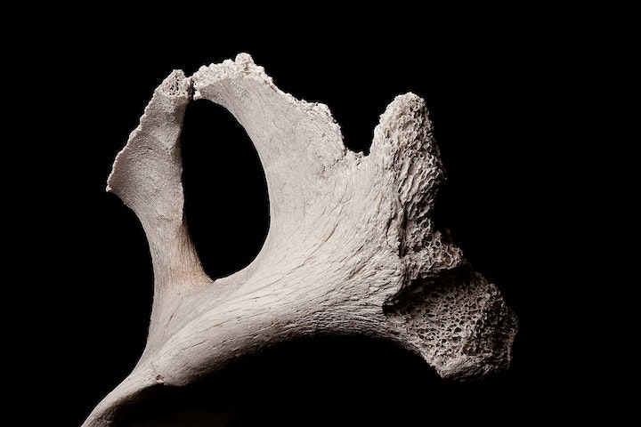 Os ossos são formados por uma matriz orgânica (composta principalmente por colágeno, uma proteína que confere flexibilidade e resistência) e uma matriz inorgânica (composta por minerais, como cálcio e fósforo, que conferem dureza e rigidez).