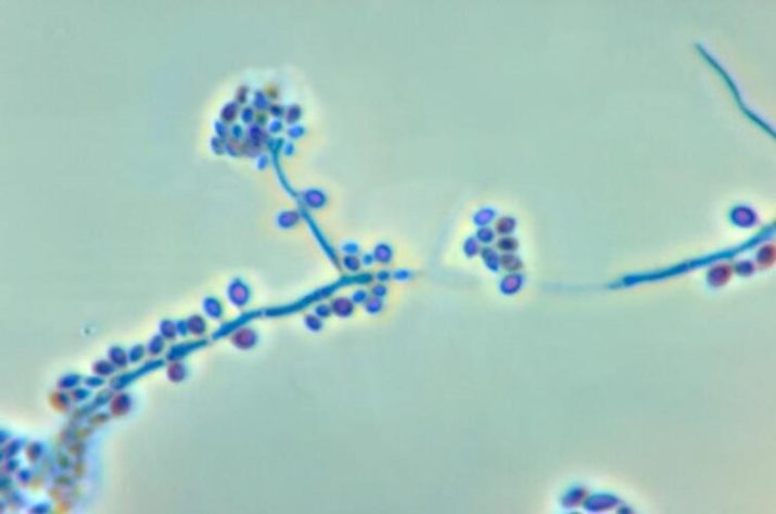 Esporotricose