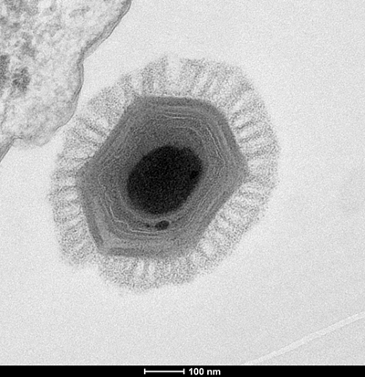 Aquecimento global  pode despertar vírus 'zumbis'