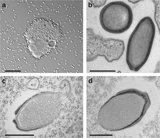 Pandoravirus: Estes são os maiores vírus conhecidos, com os genomas virais mais extensos e uma grande quantidade de genes cuja origem é desconhecida.