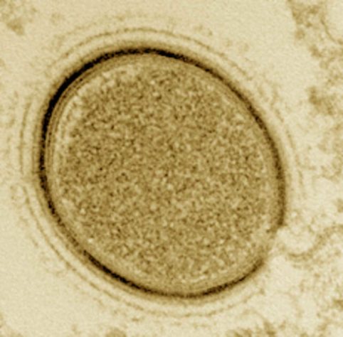 Aquecimento global  pode despertar vírus 'zumbis'