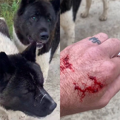 Passado o susto, o australiano chega a mostrar os ferimentos na mão, decorrentes da briga.  - montagem / reprodução instagram