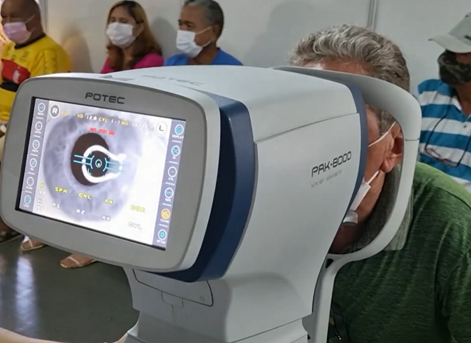 Essa não é a primeira vez que um caso como esse acontece no Brasil. Em novembro de 2023, um infecção por fungo deixou sete pacientes cegos durante um mutirão de catarata no Amapá.