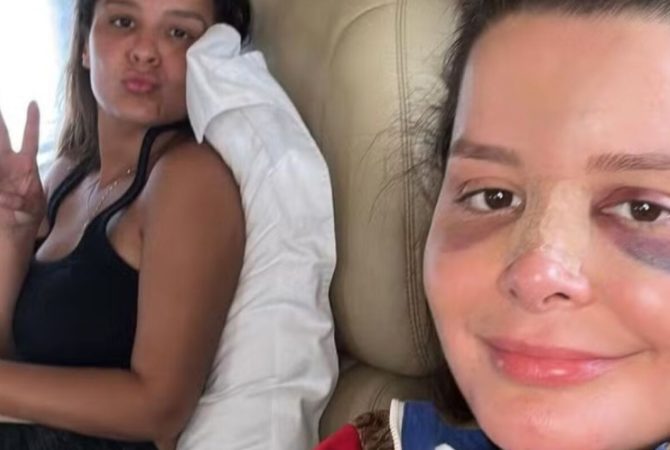Celebridades que se recuperaram após acidentes