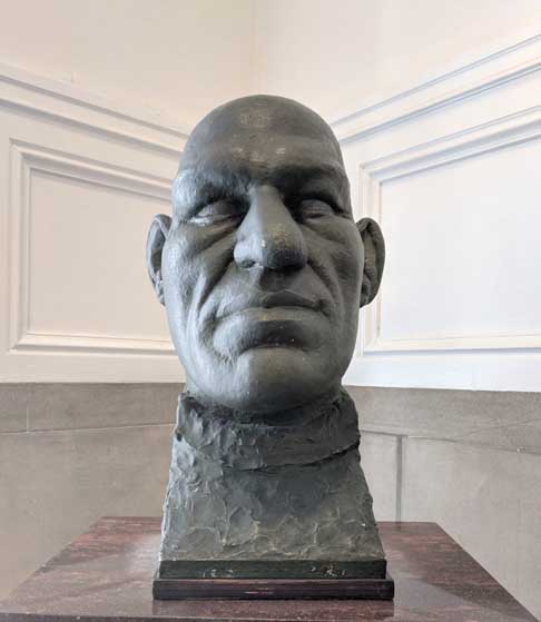 Esses moldes estão em exposição hoje, e um deles pode ser visto no Museu Internacional de Ciência Cirúrgica, que fica em Chicago. O espaço apresenta exposições que tratam de vários aspectos da medicina oriental e ocidental.