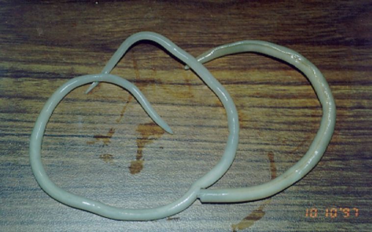 Lombriga (Ascaris lumbricoides)