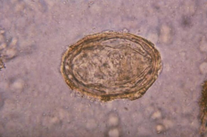 Schistosoma haematobium