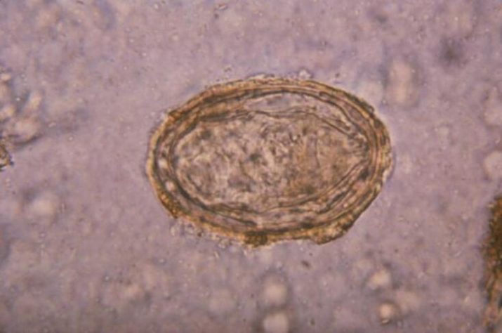 Schistosoma haematobium