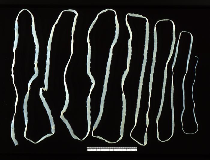 Taenia saginata e Taenia solium: Cestódeos causadores da teníase, doença intestinal com sintomas como náuseas, dores abdominais e perda de peso. Transmissão ocorre pela ingestão de carne bovina ou suína mal cozida contendo cisticercos.