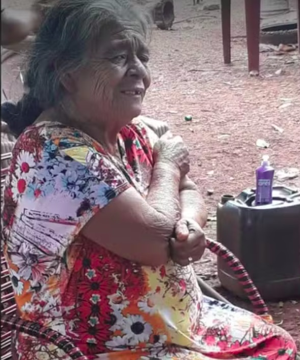 Segundo o secretÃ¡rio de saÃºde de Ponta PorÃ£, a senhora vivia em Aral Moreira, que fica a 84 km de distÃ¢ncia do hospital.