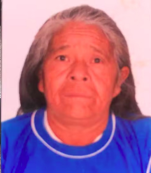 Infelizmente, mesmo com a realizaÃ§Ã£o do procedimento cirÃºrgico, a idosa nÃ£o resistiu e faleceu.