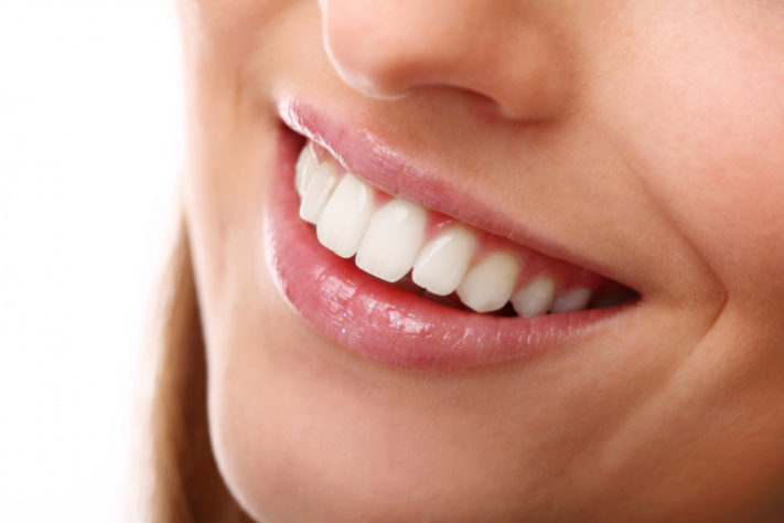 Sorriso - dentes