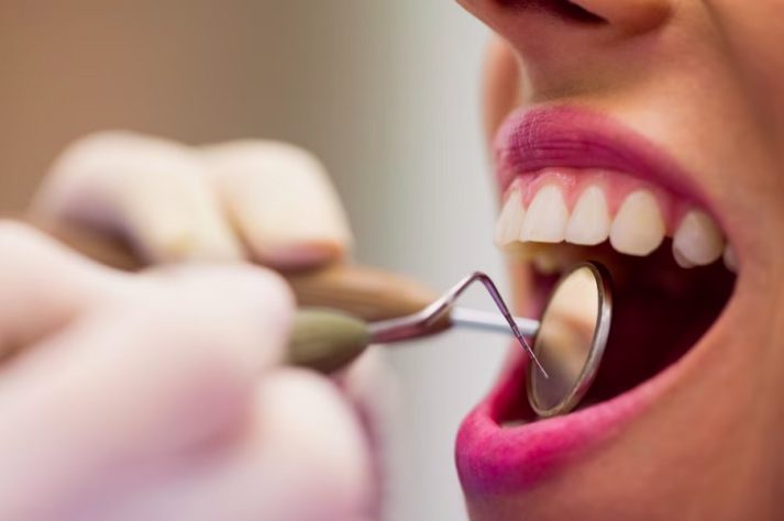 Dentes - dentista