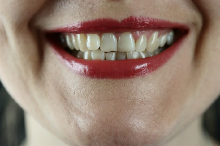 Sorriso - mulher sorrindo