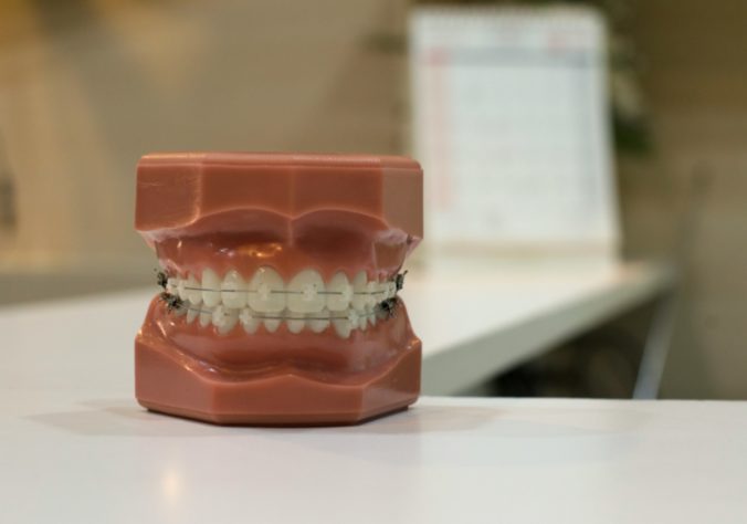 Dentes